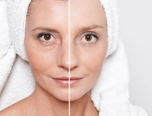 Lasers Vs. Injectables for Wrinkle Reduction: Which is Best?