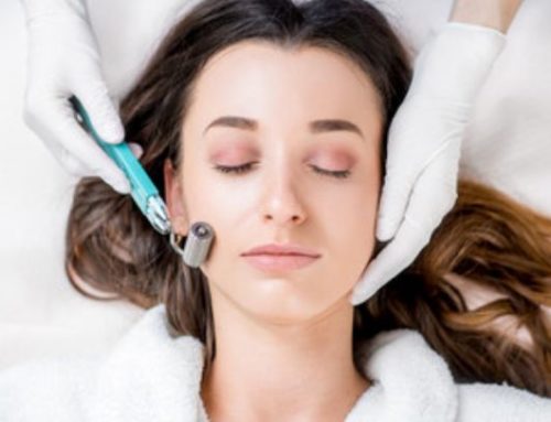 What are the Benefits of RF Microneedling Treatments?