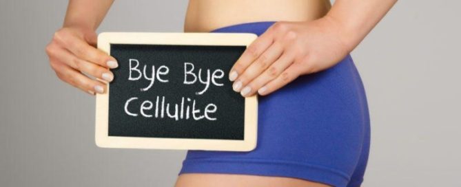 Chevy Chase Cellulite Treatments