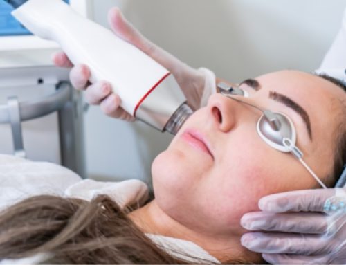 What Can RF Microneedling Treat?
