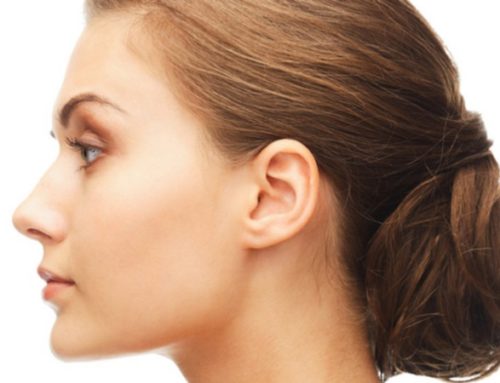 How Long Does Kybella® Swelling Last?