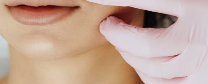 Chevy Chase Dermal Fillers