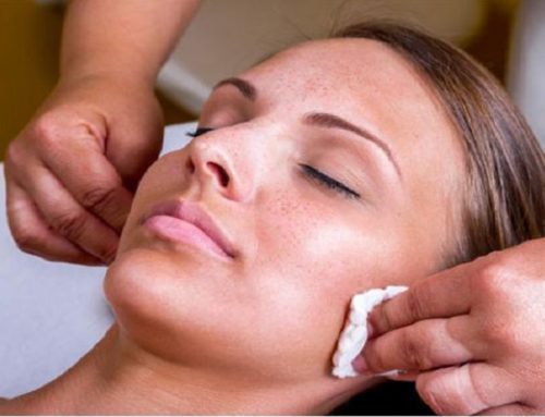 What is it Like to Do a Chemical Peel?