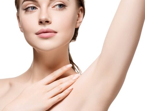 What to Expect After Laser Hair Removal