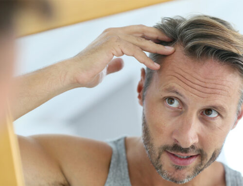 What are My Options for Hair Restoration?